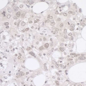Rabbit anti-ADRM1 Antibody, Affinity Purified