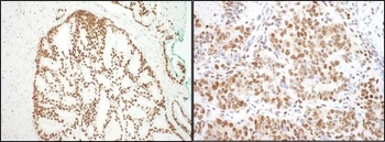 Rabbit anti-SF3B3 Antibody, Affinity Purified