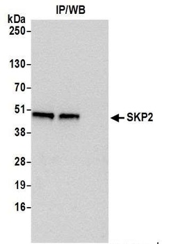 Rabbit anti-SKP2 Antibody, Affinity Purified