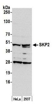 Rabbit anti-SKP2 Antibody, Affinity Purified