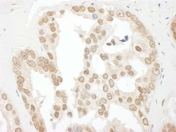 Rabbit anti-BCCIP Antibody, Affinity Purified