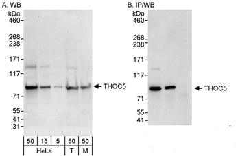 Rabbit anti-THOC5 Antibody, Affinity Purified
