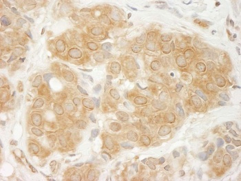 Rabbit anti-GIT1 Antibody, Affinity Purified