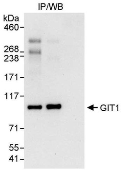 Rabbit anti-GIT1 Antibody, Affinity Purified