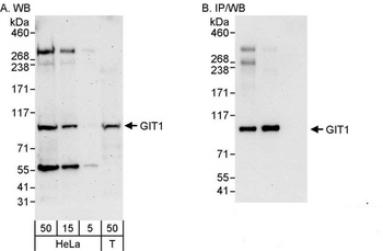 Rabbit anti-GIT1 Antibody, Affinity Purified