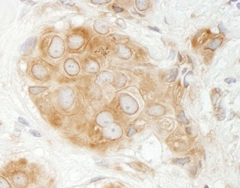 Rabbit anti-GIT1 Antibody, Affinity Purified