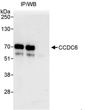 Rabbit anti-CCDC6 Antibody, Affinity Purified