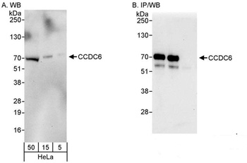 Rabbit anti-CCDC6 Antibody, Affinity Purified