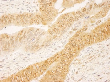Rabbit anti-RanGAP1 Antibody, Affinity Purified