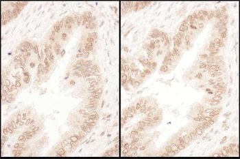 Rabbit anti-RanGAP1 Antibody, Affinity Purified