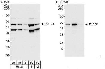 Rabbit anti-PLRG1 Antibody, Affinity Purified