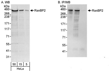 Rabbit anti-RanBP2 Antibody, Affinity Purified