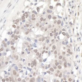 Rabbit anti-NCBP1/CBP80 Antibody, Affinity Purified