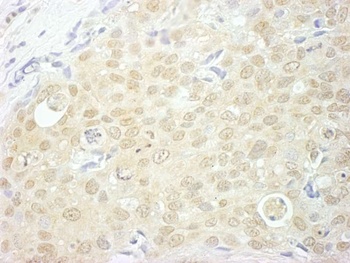 Rabbit anti-NCBP1/CBP80 Antibody, Affinity Purified