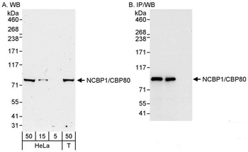 Rabbit anti-NCBP1/CBP80 Antibody, Affinity Purified
