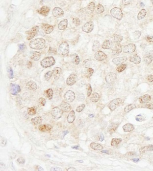 Rabbit anti-MBD4 Antibody, Affinity Purified