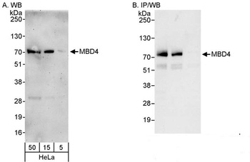 Rabbit anti-MBD4 Antibody, Affinity Purified