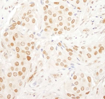 Rabbit anti-PAF49 Antibody, Affinity Purified