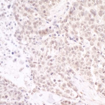 Rabbit anti-PAF49 Antibody, Affinity Purified
