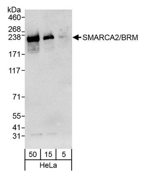 Rabbit anti-SMARCA2/BRM Antibody, Affinity Purified