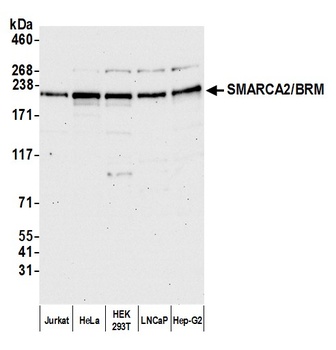 Rabbit anti-SMARCA2/BRM Antibody, Affinity Purified