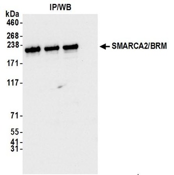 Rabbit anti-SMARCA2/BRM Antibody, Affinity Purified