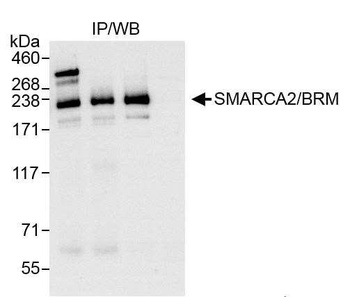 Rabbit anti-SMARCA2/BRM Antibody, Affinity Purified