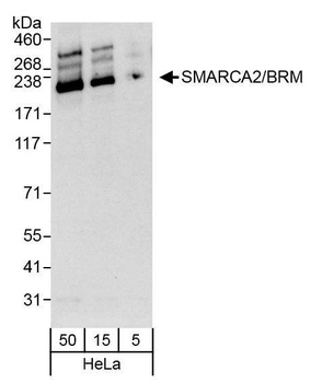 Rabbit anti-SMARCA2/BRM Antibody, Affinity Purified