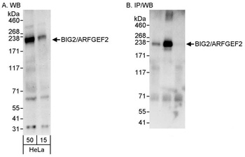 Rabbit anti-BIG2/ARFGEF2 Antibody, Affinity Purified