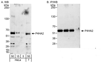 Rabbit anti-P4HA2 Antibody, Affinity Purified