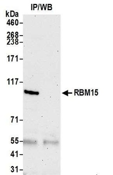Rabbit anti-RBM15 Antibody, Affinity Purified