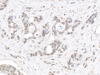 Rabbit anti-MED1 Antibody, Affinity Purified