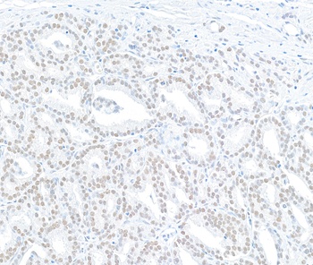 Rabbit anti-MED12 Antibody, Affinity Purified