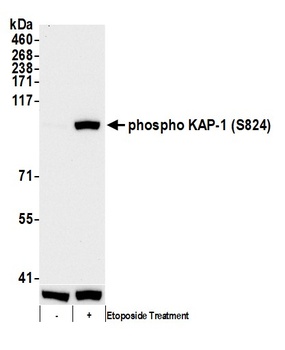 Rabbit anti-Phospho KAP-1 (S824) Antibody, Affinity Purified