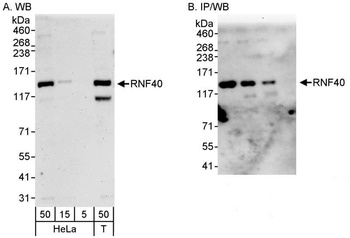 Rabbit anti-RNF40 Antibody, Affinity Purified