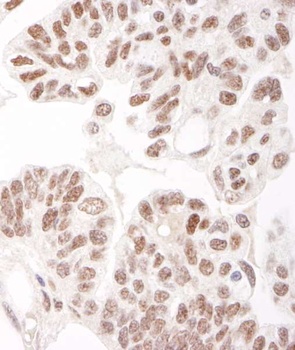 Rabbit anti-HDAC2 Antibody, Affinity Purified