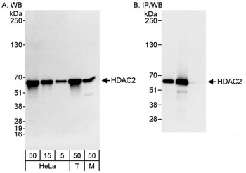 Rabbit anti-HDAC2 Antibody, Affinity Purified