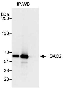 Rabbit anti-HDAC2 Antibody, Affinity Purified