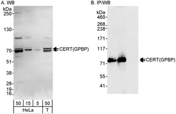 Rabbit anti-CERT/GPBP Antibody, Affinity Purified