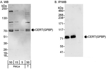 Rabbit anti-CERT/GPBP Antibody, Affinity Purified