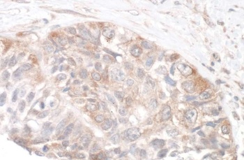Rabbit anti-Rictor Antibody, Affinity Purified