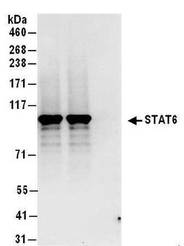 Rabbit anti-STAT6 Antibody, Affinity Purified
