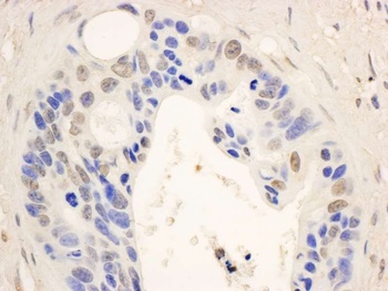Rabbit anti-STAT6 Antibody, Affinity Purified