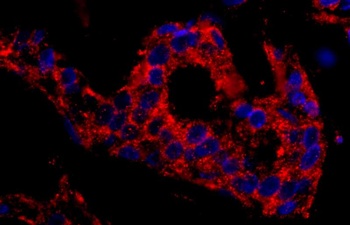 Rabbit anti-SNX1 Antibody, Affinity Purified