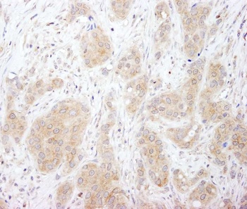 Rabbit anti-SNX1 Antibody, Affinity Purified