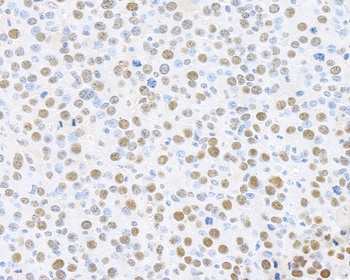 Rabbit anti-PCNA Antibody, Affinity Purified