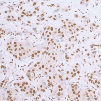 Goat anti-Rabbit IgG Heavy and Light Chain Highly Cross-Adsorbed Antibody HRP Conjugated