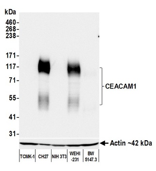 Rabbit anti-CEACAM1 Recombinant Monoclonal Antibody [BLR240L]
