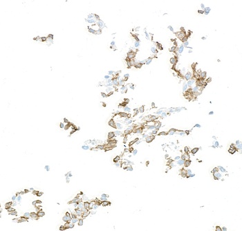 Rabbit anti-PDGFR beta Recombinant Monoclonal Antibody [BLR242L]