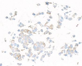 Rabbit anti-PDGFR beta Recombinant Monoclonal Antibody [BLR242L]